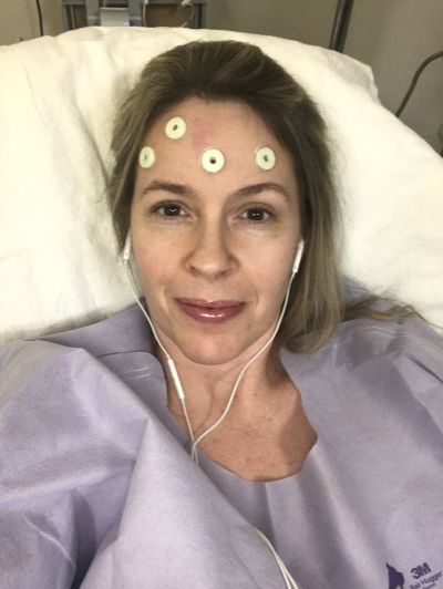 BEFORE Brain Surgery Selfie